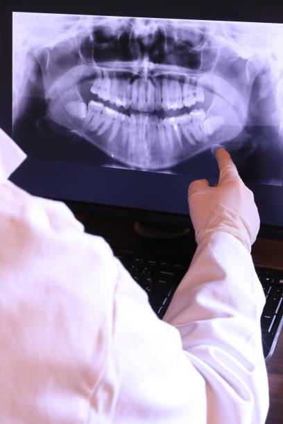 Best Emergency Wisdom Teeth Removal in Nd Lake, WI